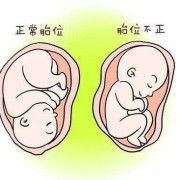 胎儿发动前有什么预兆，身体会有什么症状呢,胎儿发动的条件是什么