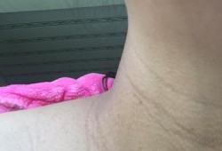 孕期脖子变黑长纹（孕妇脖子变黑是怎么回事呢？正常的吗）