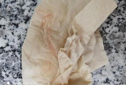 怀孕期间白带有血丝（怀孕40天白带带血丝是怎么回事呀?该不会是要流产了吧?呜呜）