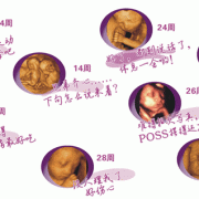 整个孕期要做几次四维彩超？一般只做1次就可以吗,怀孕期间做几次四维彩超合适