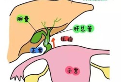 孕期胆囊部位疼痛怎么办,孕期胆於的症状