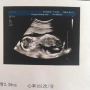 十八周胎儿有多大（怀孕18周了胎儿在肚子的什么位置？胎动是怎样的）
