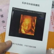 孕晚期吃什么胎儿速长？怀孕36周吃什么食物胎儿长得快,四维有这个一般是女孩