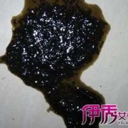 孕妇拉肚子拉黑色稀便是什么情况呢,孕期便稀是怎么回事