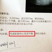胎儿没你想的那么脆弱（胎停前其实有暗示信号）