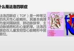胎儿法洛四联症（胎儿法洛四联症能要吗）