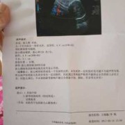 胎儿彩超多少钱（普通彩超能查出胎儿畸形吗）
