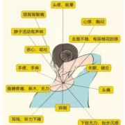 孕期颈椎病（孕期颈椎病）