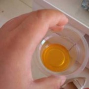 孕妇尿红对胎儿影响吗（孕妇尿红对胎儿影响吗孕晚期）