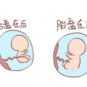 胎盘前壁和后壁胎儿图（胎盘前壁和后壁胎儿图片对比）