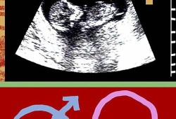 胎儿是什么（如果一个男生老是叫一个女生"妹妹""孩子"是什么意思）
