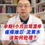 孕妇湿疹很严重怎么办呢,孕期湿疹治疗方案