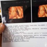 孕早期胎儿偏小（孕早期胎儿偏小一周正常吗）