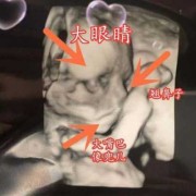 胎儿偏大是男孩吗（胎儿偏大是男孩吗?）