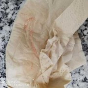 孕期白带有血（孕九周，白带带血丝是怎么回事）