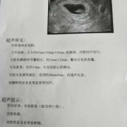 宫腔积液孕期（宫腔积液孕期三个月时候会不会好）