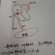 静脉导管对胎儿的意义（静脉导管对胎儿的意义是什么）