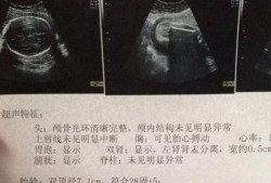 b超胎儿体重准吗（B超胎儿体重准吗）