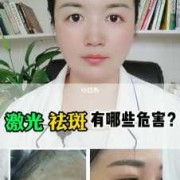 孕妇可以激光祛斑吗,激光对胎儿有影响吗?