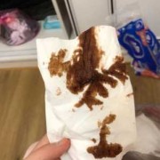孕期就黑血（孕期黑血是好转吗）