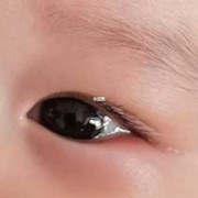 五个月女胎儿（5个月宝宝眼睛眼屎多）