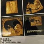 胎儿五官什么时候形成（婴儿脸型什么时候定型）