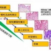 肠上皮的结构特点,胎儿肠外漏导致原因