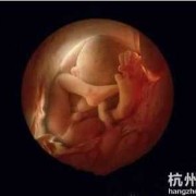 怀孕28周胎儿（怀孕28周胎儿腹部肠管回声增强是怎么回事）