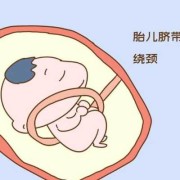 胎儿脐带绕颈一周是什么意思（胎儿脐带绕颈一周怎么才能转过来）
