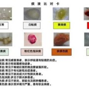 孕37周喉咙痛有黄痰，会感染胎儿吗,孕妇咳黄痰对胎儿影响孕晚期