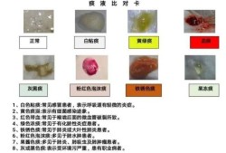 孕37周喉咙痛有黄痰，会感染胎儿吗,孕妇咳黄痰对胎儿影响孕晚期