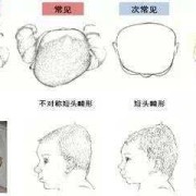 胎儿头扁（胎儿头扁长属于畸形吗）