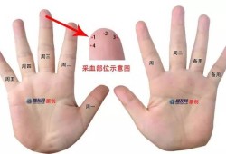 孕妇如何检测血糖？要抽血吗？还是扎手指就可以了,孕期抽血检查需要空腹吗
