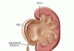 胎儿肾盂分离是什么意思,胎儿右侧肾盂分离是什么意思图片