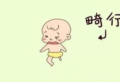 一般胎儿畸形几率大吗（一般胎儿畸形几率大吗知乎）