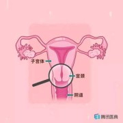 预产期到了，宫颈不软化应该怎么办呢,孕期宫颈软是什么意思