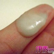孕期白带脓球（脓性白带是怎样的）