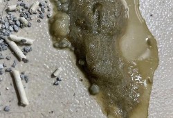 孕期吐绿水（孕期吐绿水很苦是什么原因）