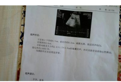 胎儿没胎心是什么原因，是什么原因导致的呢,胎儿无心跳是什么原因导致的