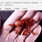 五个月引产都需要什么,5个月胎儿引产后多久可以再孕