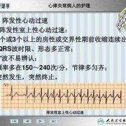 胎儿心率失常（胎儿心率失常是什么原因引起的）