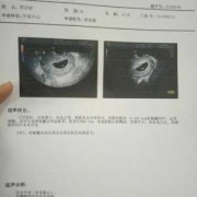 18周胎儿视频（怀孕18周胎心不好找是因为小孩在宫内到处跑吗）