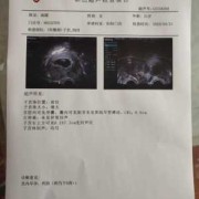 产检老公可以用献血证证明吗,男子用血喂养胎儿视频