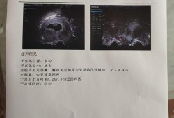 产检老公可以用献血证证明吗,男子用血喂养胎儿视频