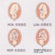 胎儿背部可见w形压迹（胎儿颈部U形压迹是什么意思）