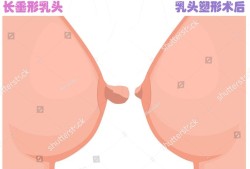 孕期乳头有白色分泌物（孕期乳头有白色分泌物正常么）