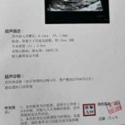 胎儿鼻骨发育不良（怀孕产检，nt检查结果看不到鼻骨咋办，胎儿会不会有问题呢）