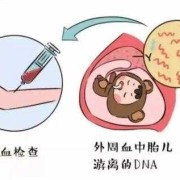 胎儿送检（早产儿医生为何建议做基因检测）