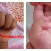 胎儿手的发育（婴儿手不握拳正常吗？在什么时候小宝宝能正常握拳）