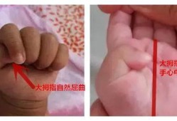 胎儿手的发育（婴儿手不握拳正常吗？在什么时候小宝宝能正常握拳）